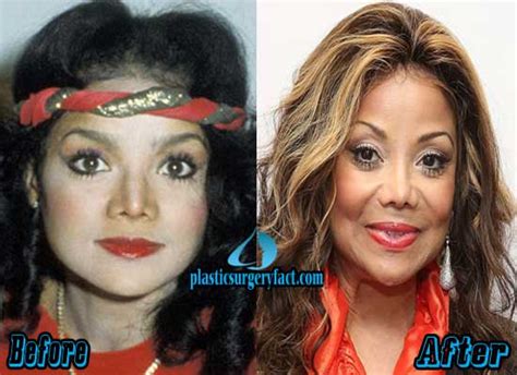 latoya jackson before plastic surgery|La Toya Jackson Plastic Surgery